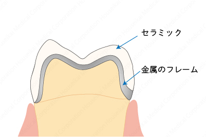 crown-a-06