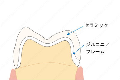 crown-a-07