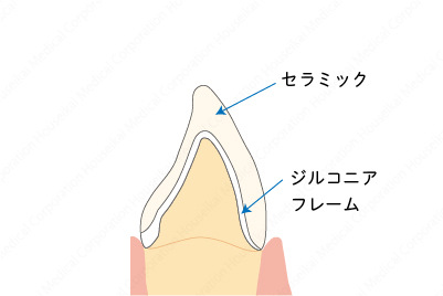 crown-b-03