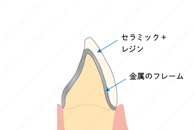 crown-b-05_1