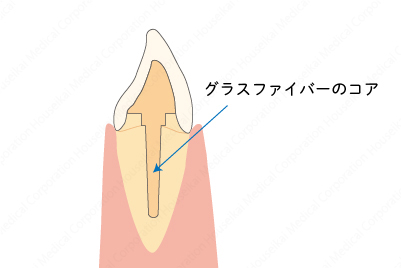 fiber-core01